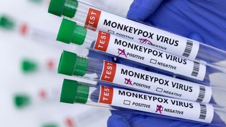 São Paulo registra primeira morte por varíola dos macacos