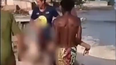 Surfista é atacado por tubarão em Olinda e socorrido com ferimentos graves