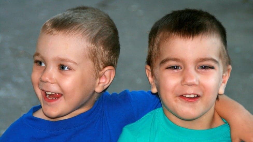 Superfecundação heteroparental: gêmeos de pais diferentes