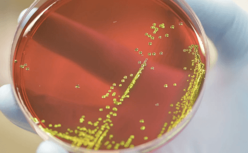 Mais de 3 milhões de crianças morreram no mundo por infecções resistentes a antibióticos
