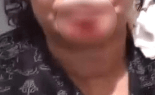 Companheiro arranca pedaço do queixo de mulher com mordida e é preso