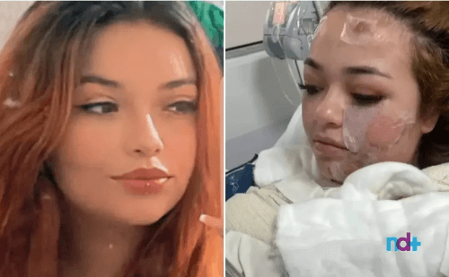 Jovem morre após sofrer queimaduras em motel; caso é investigado