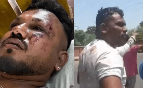 Imagens mostram único sobrevivente caminhando após queda de avião na Índia