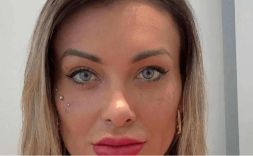 Andressa Urach relata arrependimento após cirurgia estética nos olhos