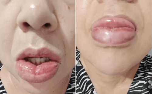 Colgate suspende creme dental após 1,2 mil queixas de reações adversas