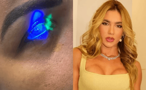 Mulher diz ter ficado cega após usar sérum da marca de Virginia Fonseca