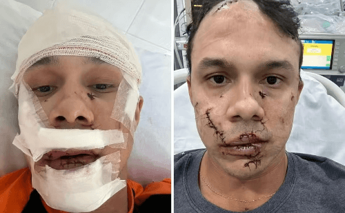 Suspeito do DF confessa ataque brutal a personal no interior de SP