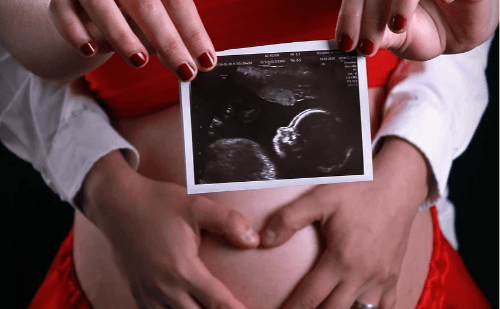 Estudo indica que mães podem ter filhos sempre do mesmo sexo