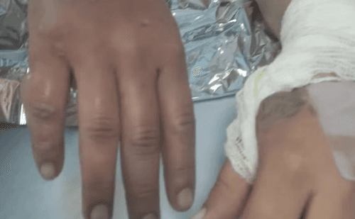 Homem é preso após incendiar ex-namorada em Sumaré