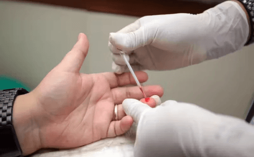 HIV usa células T intestinais para se esconder e evitar antirretrovirais, aponta estudo de Yale