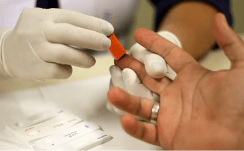 Casos de hepatite A dobram no RJ e afetam população jovem