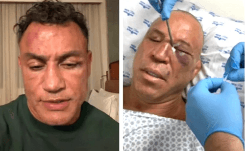 Wanderlei Silva relata dores e lapsos de memória após luta tumultuada com Popó